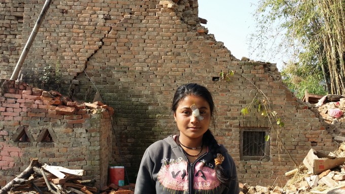 Anjana has some wounds in her body including nose